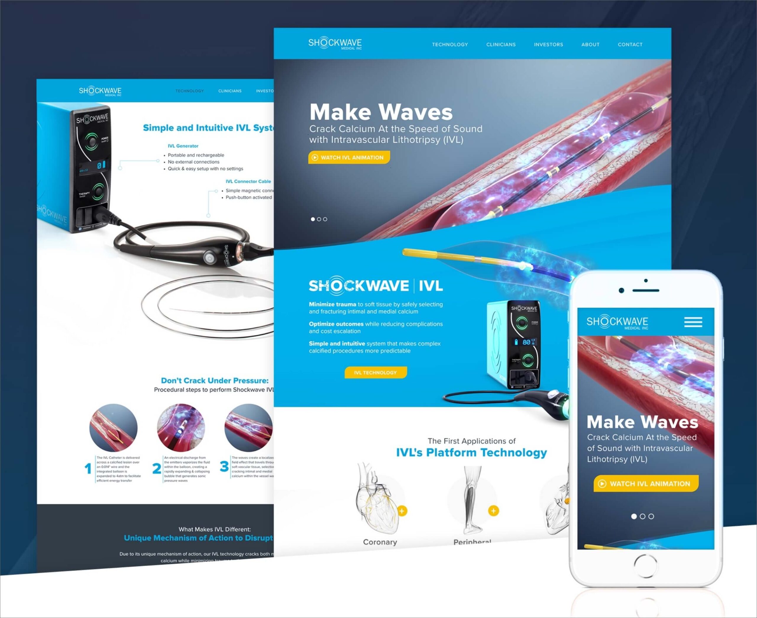 Screenshots of Shockwave Medical's new modern redesigned website. The new website uses the brand's colors with engaging visuals and mobile response.