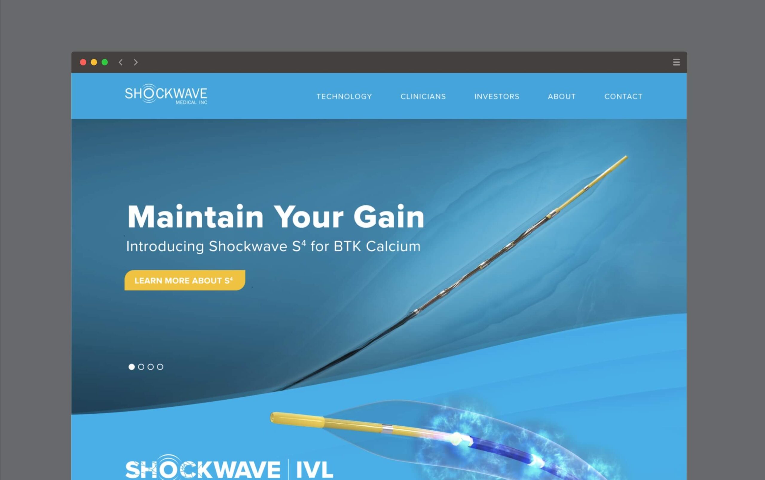 Screenshot of Shockwave Medical's new product page, using variations of blue and a device having an electrifying filter on the end to illustrate the shockwaves.