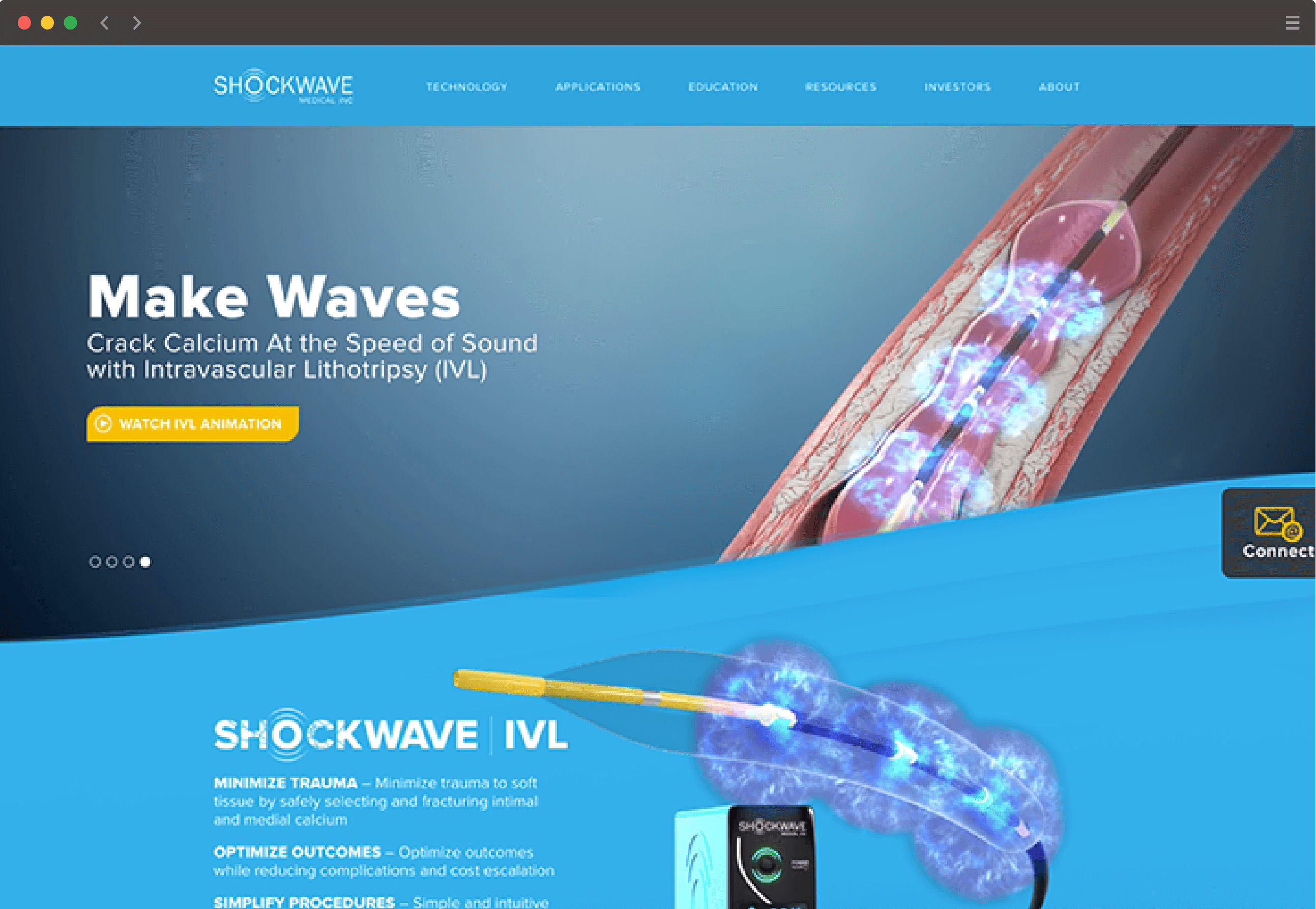 Screenshot of Shockwave Medical's redesigned homepage using modern visuals showcasing how the medical devices works, using the brands blue colors.